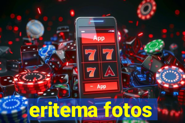 eritema fotos